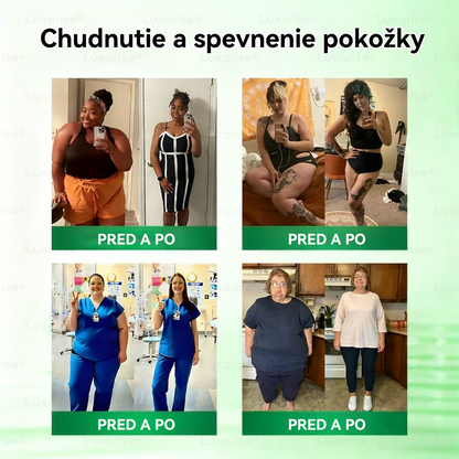 Oficiálny obchod | 👩‍⚕️❤️𝑳𝒖𝒙𝒂𝒓𝒊𝒔𝒆® Pokročilá nano-mikroihlová náplasť 10 v 1 s moringou a berberínom (aplikujte raz denne) ✅ Efektívne pri liečbe obezity, cukrovky, spánkového apnoe a problémov s kĺbmi